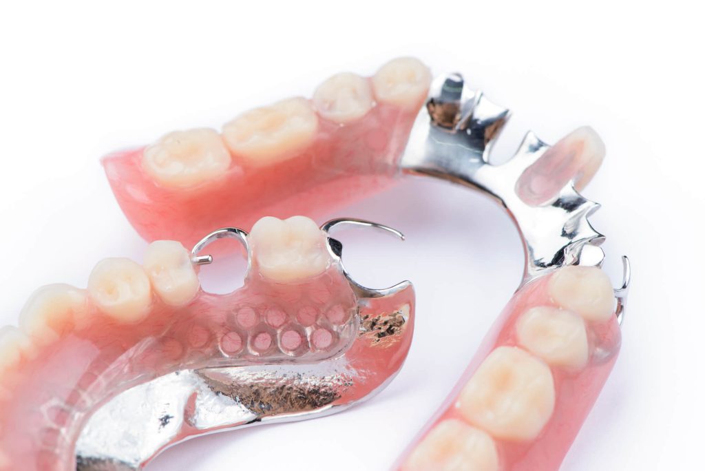 Dentaduras postizas removibles