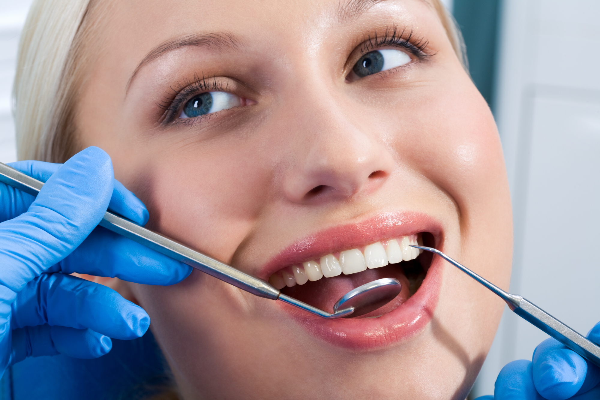 Dente Raspado Raspador dental casero: qué es y cuál es el mejor escalador