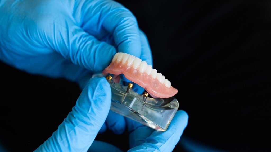 dentaduras postizas esteticas